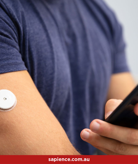 young man wearing an adhesive continuous glucose monitor (CGM) sensor to manage his insulin needs