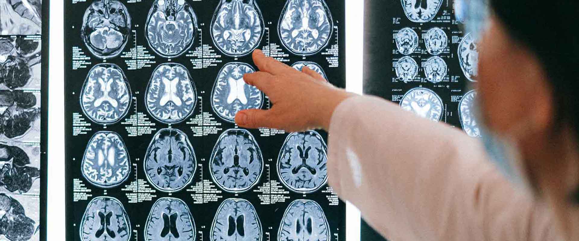 Doctor reading medical brain imaging film slides